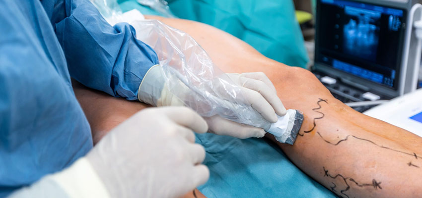 Minimally Invasive Cardiac Surgery (MICS)